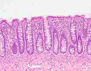 histology specimen