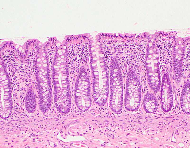 ASCP HT Exam: Practice Questions